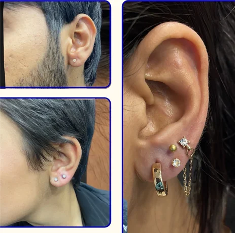 Ear Piercing in Lucknow